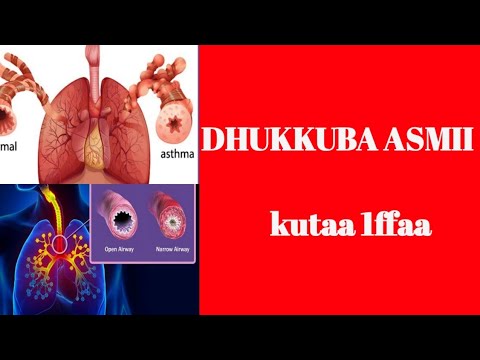 DHUKKUBA ASMII Asthma Kutaa 1ffaa