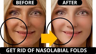 ? SMILE LINES REMOVAL EXERCISE (NASOLABIAL FOLDS) LIFT JOWLS, SAGGY SKIN, FOREHEAD, DOUBLE CHIN