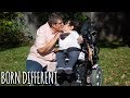 Interabled Couple Found Love On Dating Site | BORN DIFFERENT