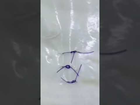 طريقه فك الغرز الجراحيه في اقل من ٥ثواني دكتور حسن   ترند تصميمي مصر مشاهير