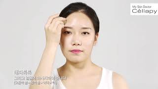 Dr.Cellapy 시술 동영상