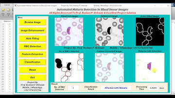 Automated Malaria Detection In Blood Smear Images Using Image Processing || IEEE Based Projects