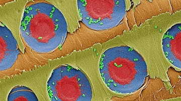 Making Simple xylem filter from Pine tree for providing safe drinking water.