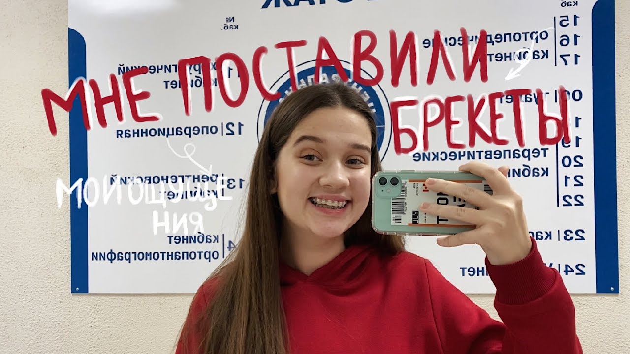 МНЕ ПОСТАВИЛИ БРЕКЕТЫ! // Как Ставят Брекеты?