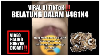 Viral‼️ Belatung Dalam V4g1n4 Di Tiktok, Ini Kata Ahli