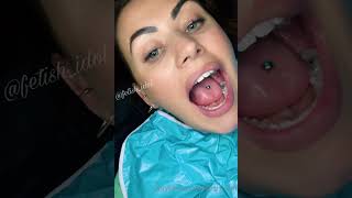 Girl at the dentist, show all the metals in her mouth