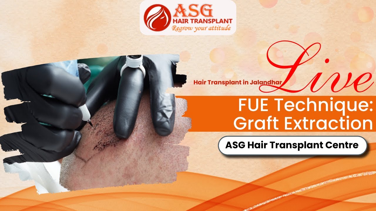 Hair Transplant in Jalandhar – Live FUE Technique: Graft Extraction | ASG Hair Transplant Centre