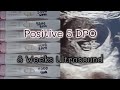 Positive Pregnancy Test Line Progression 5DPO to 13DPO | 8 Weeks Ultrasound