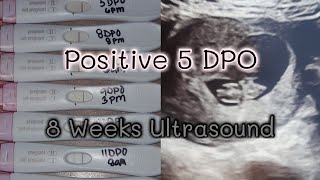 Positive Pregnancy Test Line Progression 5DPO to 13DPO | 8 Weeks Ultrasound