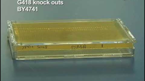 A high-throughput approach to examine the organelle morphology in S. cerevisiae worldwide