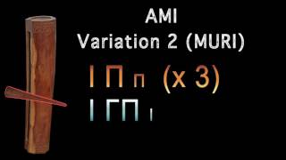 Toere AMI Variation 2 (MURI)