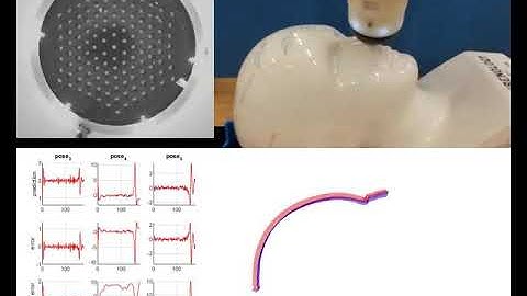 Tactile sensor (TacTip) feeling a human head