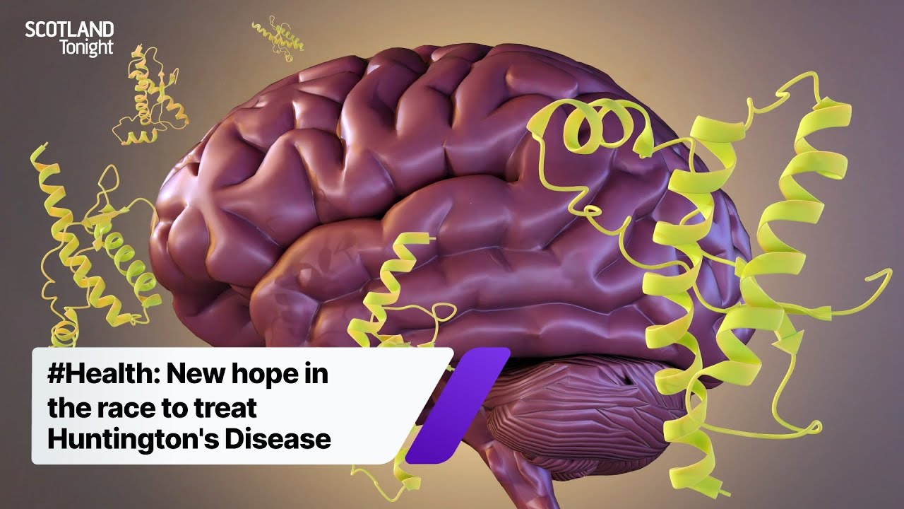 New hope in the race to treat Huntington's Disease