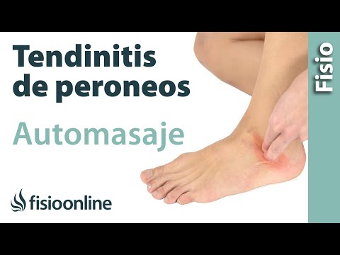 Video: ¿Es tendinitis peronea o fascitis plantar?