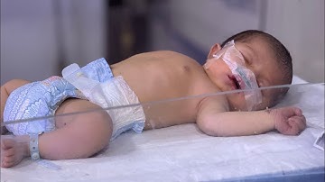 Newborn with HIE Grade 3 Admitted in NICU | Fighting for Life Begins