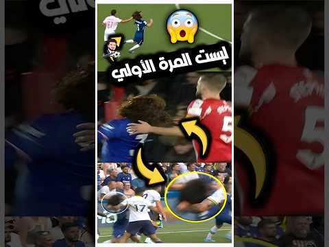 واقعة شد شعر كوكوريلا حدثت اكثر من مره