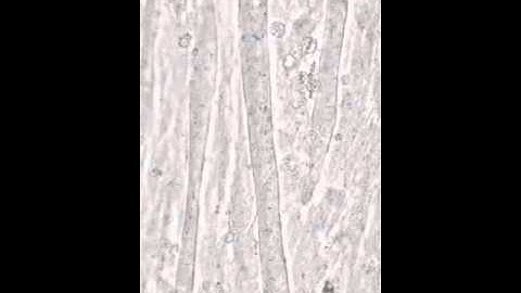Spatial control of optogenetically actuated C2C12 myotubes