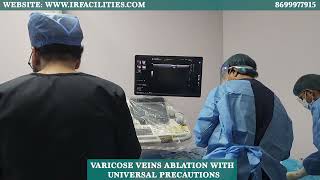 Varicose Veins Ablation With Universal Precautions