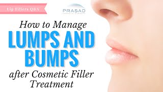 How to Manage Bumps and Lumps from Cosmetic Fillers