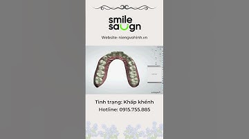 Phác đồ niềng răng khấp khểnh - Smilesalign