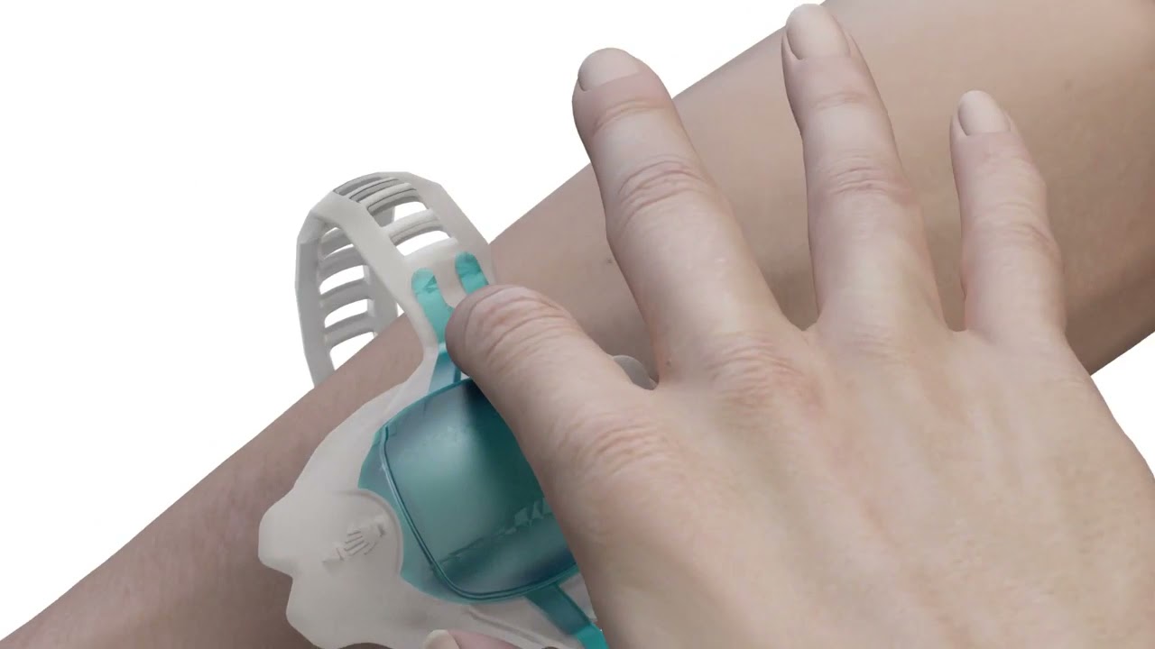 Animation  How to use Vacuderm™ and improve your success rate in venous access