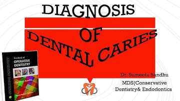 Dental caries|Diagnosis of dental caries