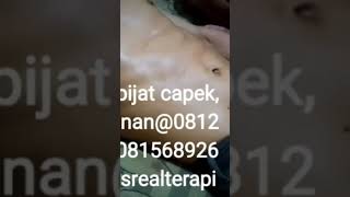 terapi pijat tradisional, pijat d bagian perut