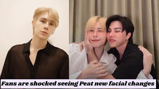 Peat new facial changes made Fans shocked ¦ He undergo a surgery ¦ FortPeat