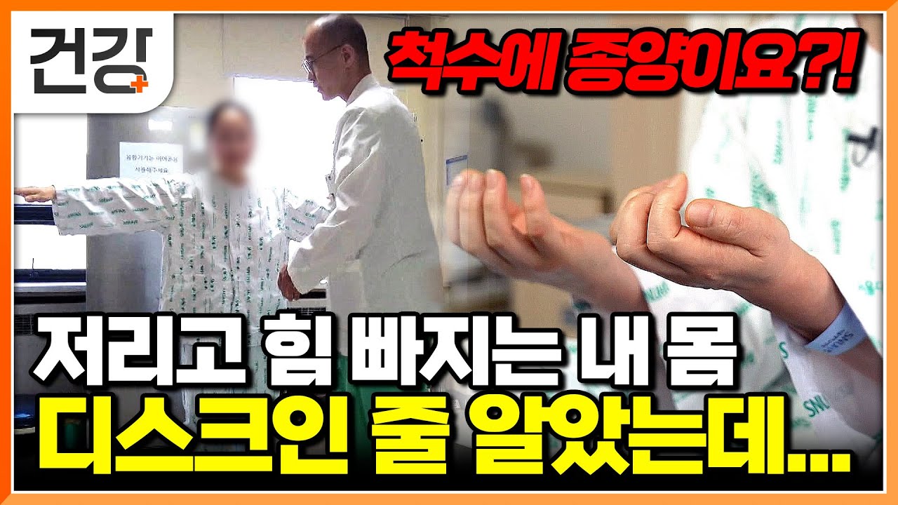 "늙어서 그런 줄 알았지..." 물리치료도 침도 소용없던 무서운 병, 척수 종양｜조금만 늦으면 신경마비｜고난도의 척추척수종양 수술 과정｜명의｜#EBS건강