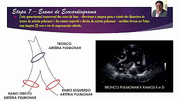 O que significa tronco pulmonar?