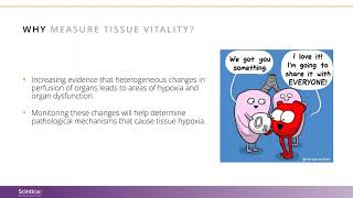 The 4 W’s of Microcirculation and Tissue pO2