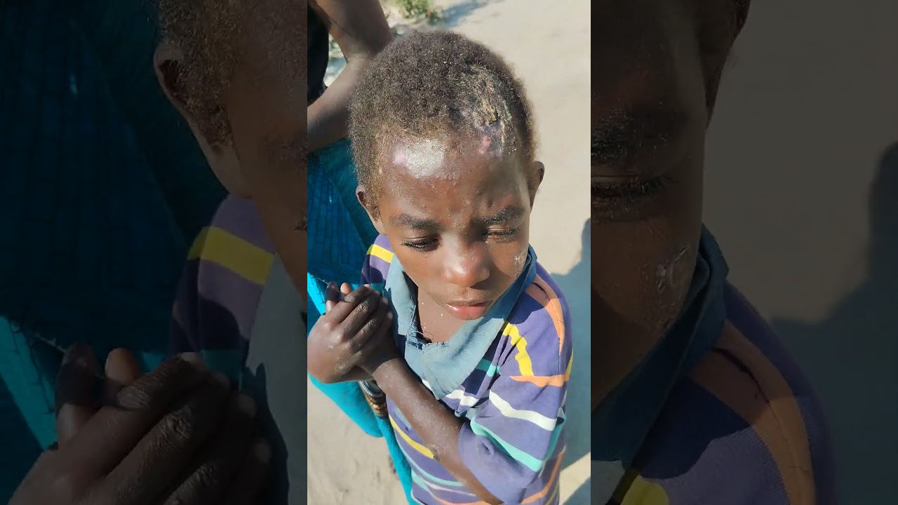 Ajudei Está #Criança Com Cesta Básica Remédio #mocambique # Foi Uma Supresa Para Família #shorts .