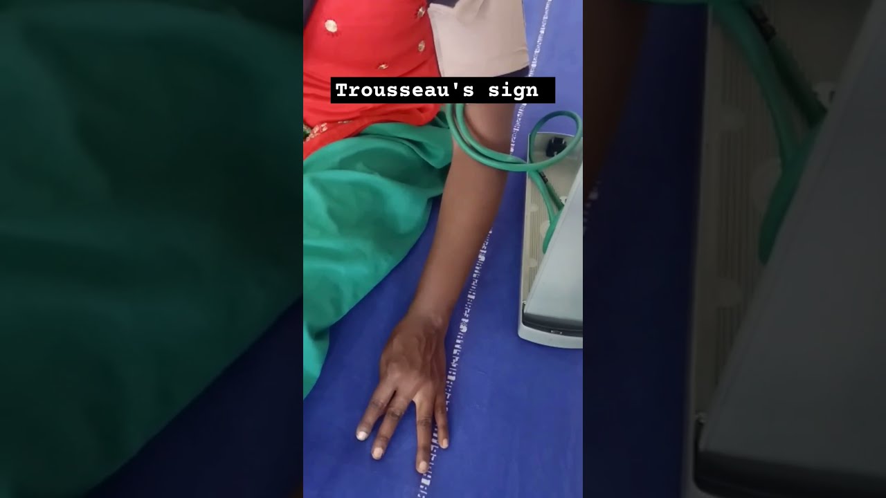 Trousseau S Sign In Latent Tetany Hypocalcemia 