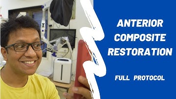 Anterior Composite Restoration | Class IV build up + Diastema Closure | Bioclear + Mylar Matrix