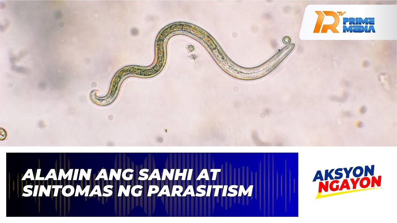 Alamin Ang Sanhi AtSintomas Ng Parasitism | Aksyon Ngayon