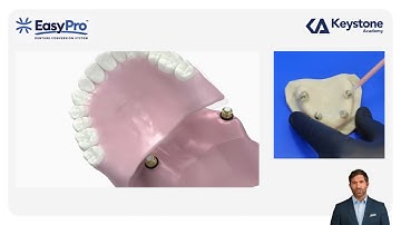 The EasyPro™ Denture Conversion System