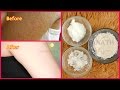 How to Get Rid of Tiny Red Bumps, Rashes from Face, Arms, Hips || Chicken Skin Treatment