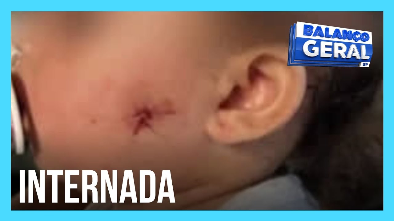 Reportagem do Dia: PM atinge criança com arma de airsoft em São Paulo