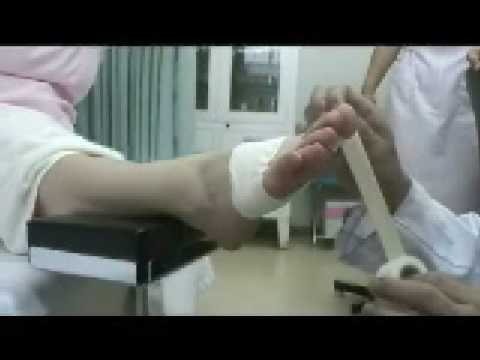 母趾種子骨障害のテーピング 足の親指の付け根の着地面の痛み Youtube