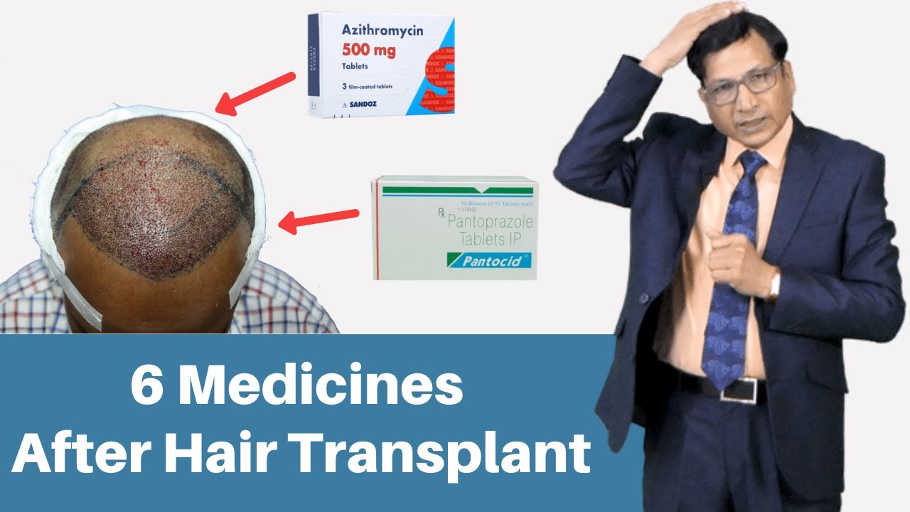 Do you need to take medication after hair transplant