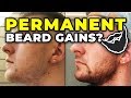 PROOF That Minoxidil Beard Gains Are PERMANENT After Stopping!?