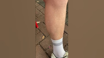 Calf Muscle Twitching and Rippling - Boss post ride