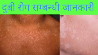 Pityriasis versicolor(दुबी रोग) in nepali|Dr Guru Poudel(Dermatologist) |doctor sathi