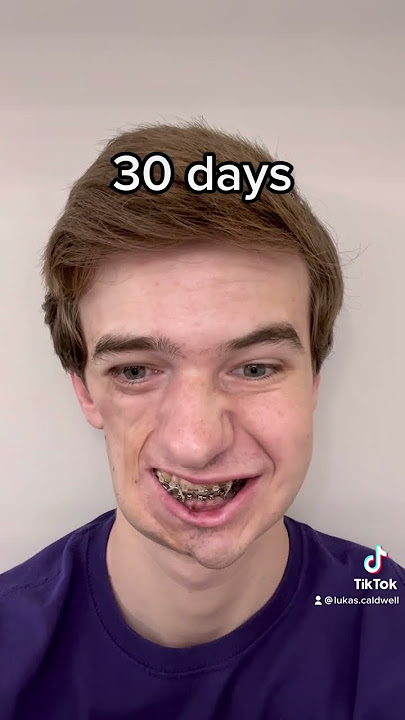 100 Days After Surgery!