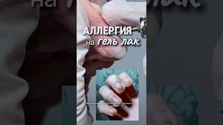если АЛЛЕРГИЯ на гель лак, это покрытие ПОДХОДИТ