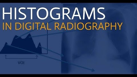 Histograms in Digital Radiography