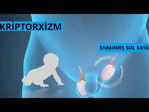 Video: Hayası enməmiş iti sterilizasiya etmək lazımdırmı?