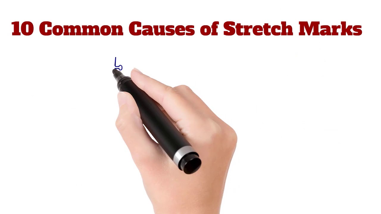 10 Causes of stretch marks YouTube