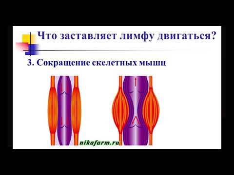 Жизнь с лимфедемой