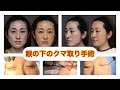 【美容手術】目の下のクマ取り手術　閲覧注意　　表ハムラによる手術動画です。